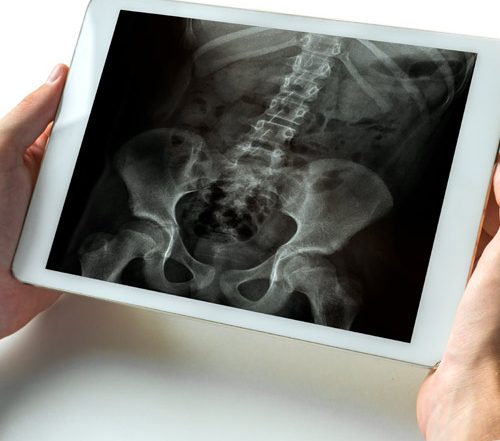 Chiropractic Spine Xray